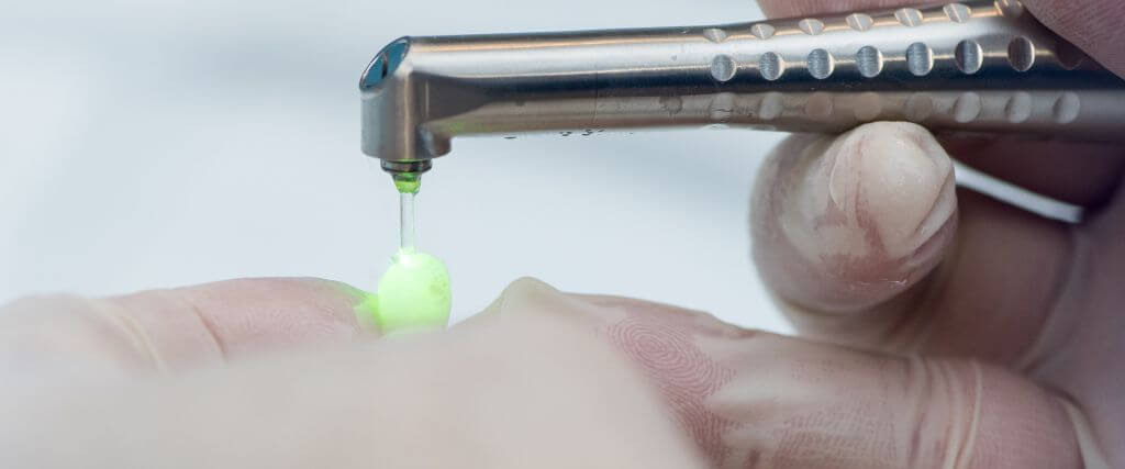 Dental laser drilling tooth for filling.