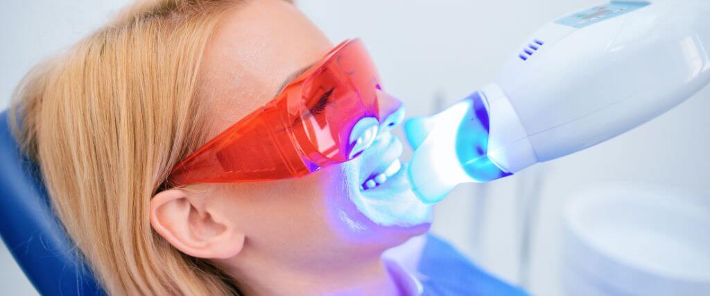 Does Professional Teeth Whitening Really Work?