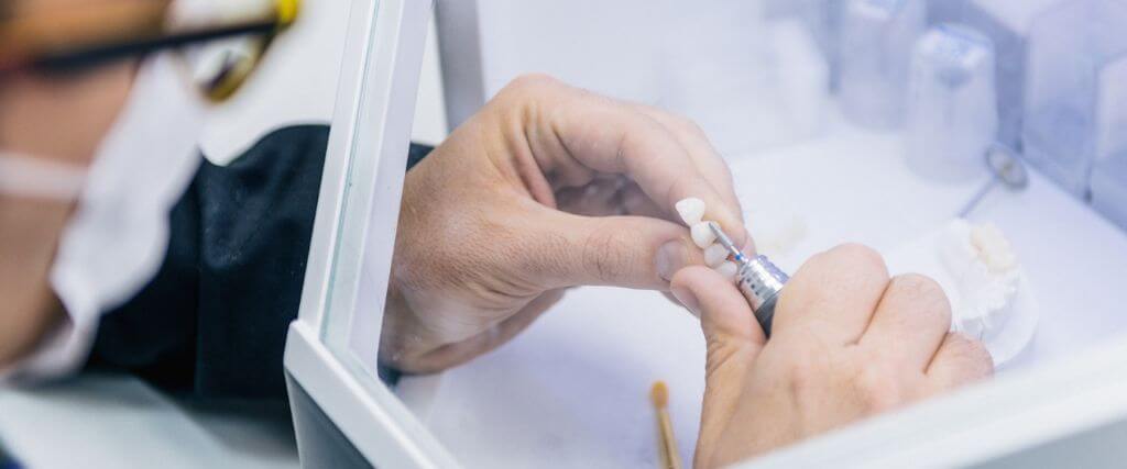 From Cavities to Missing Teeth