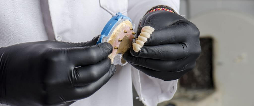 Implant-Supported Dentures