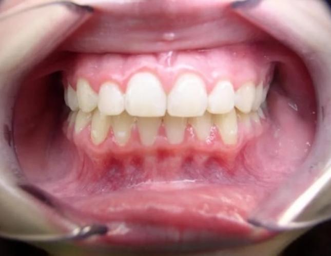 Case 16 after