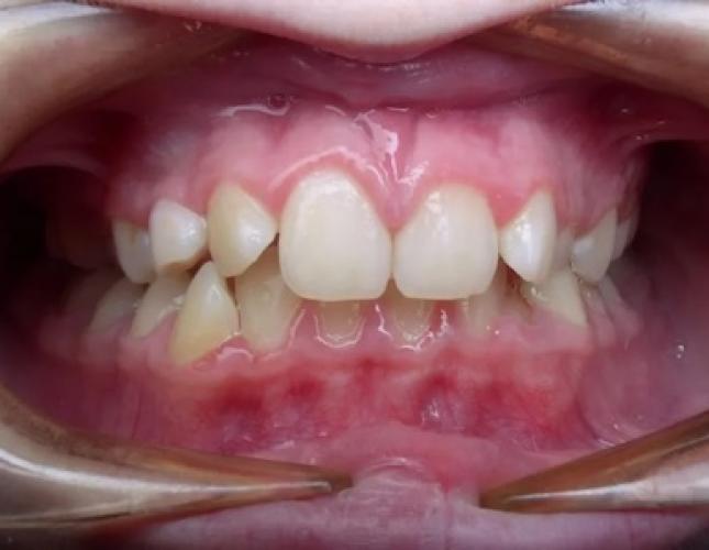 Case 16 before