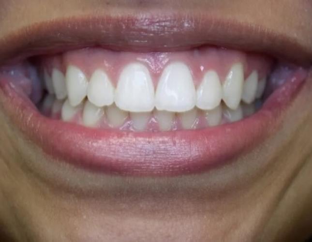 Case 7 after