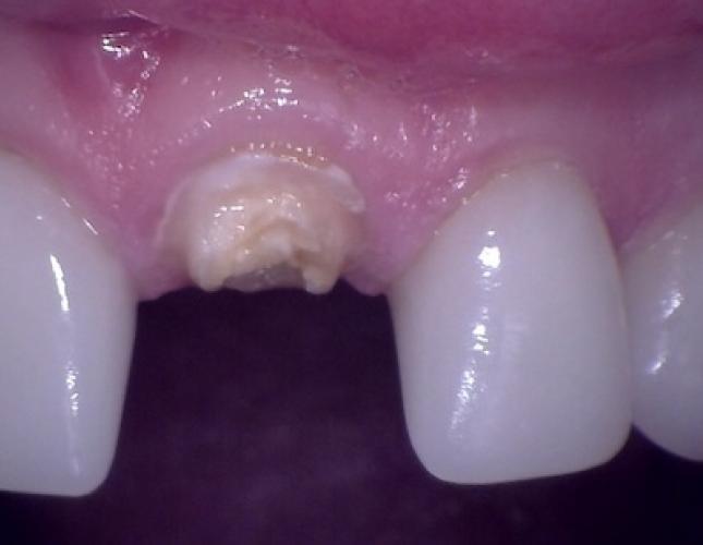 Cases 18 before