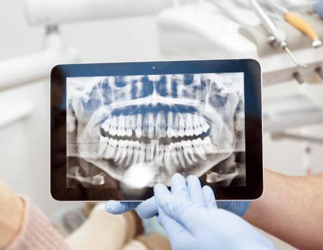 Are Dental X-Rays Safe? Debunking Myths and Addressing Concerns