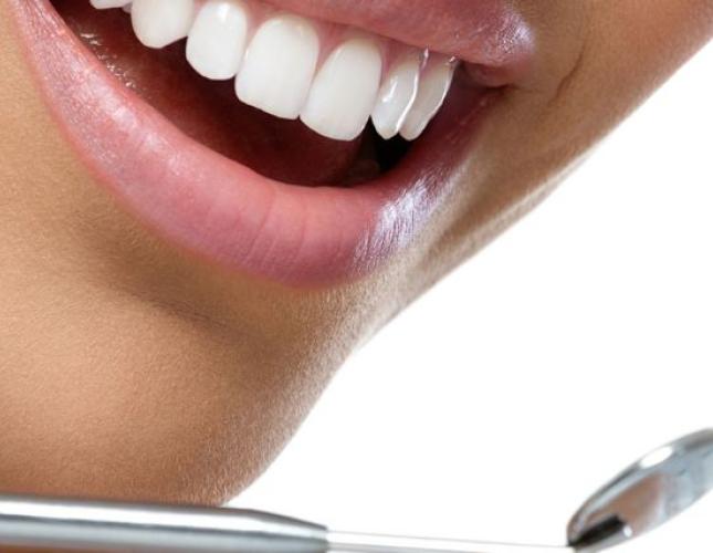 Cavity-Fighting Foods: What to Include in Your Diet