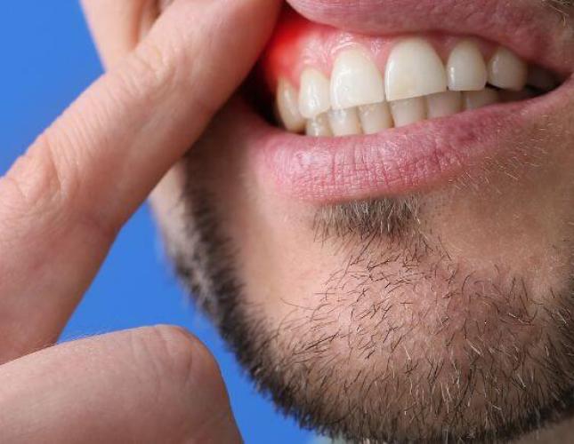 Holistic Approaches to Managing Periodontal Disease: Mind-Body Wellness