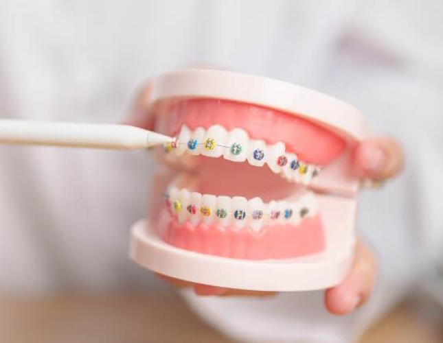Transform Your Smile: A Comprehensive Look at Orthodontic Care