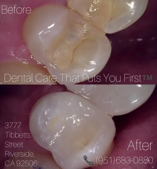 DENTAL CARE THAT PUTS YOU FIRST™